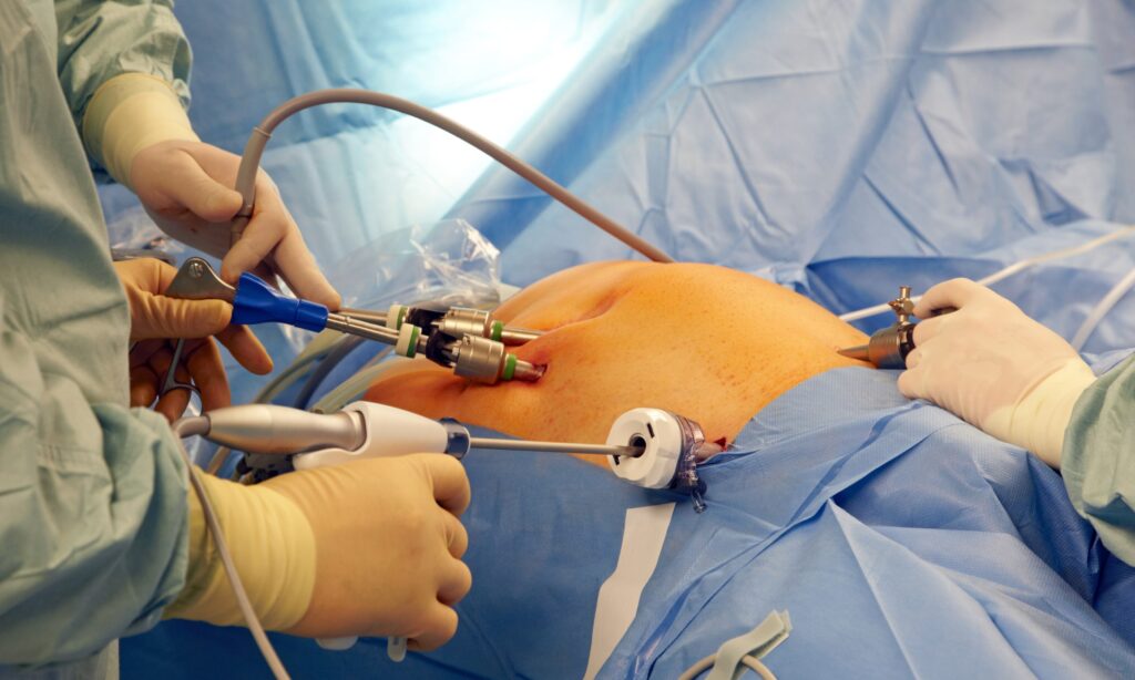 Laparoscopic & Endoscopic Urology Surgery