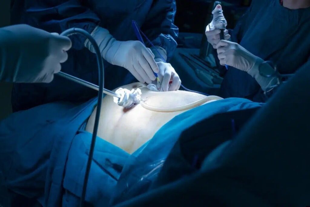 Laparoscopic Urology Treatment
