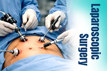 Is Laparoscopic Surgery Painful